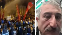 Bursa’da ‘İmamoğlu’ protestosu: CHP İl Başkanı gözünden yaralandı